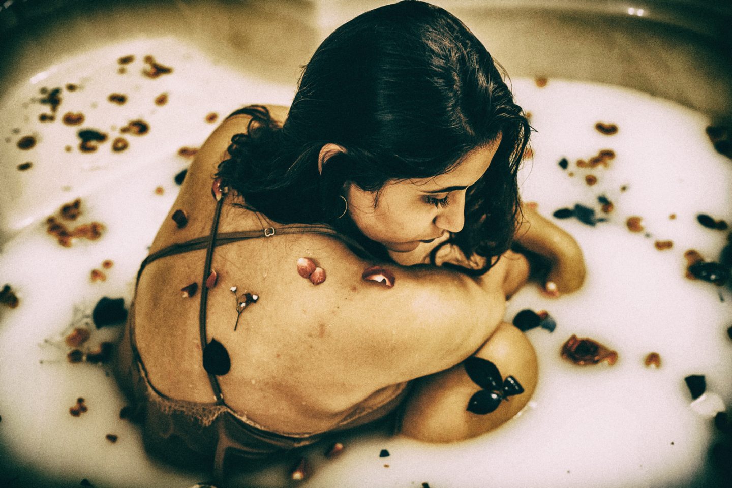 Disponibile l'app HIDRAdisk per valutare l'impatto dell'Idrosadenite Suppurativa sulla QoL