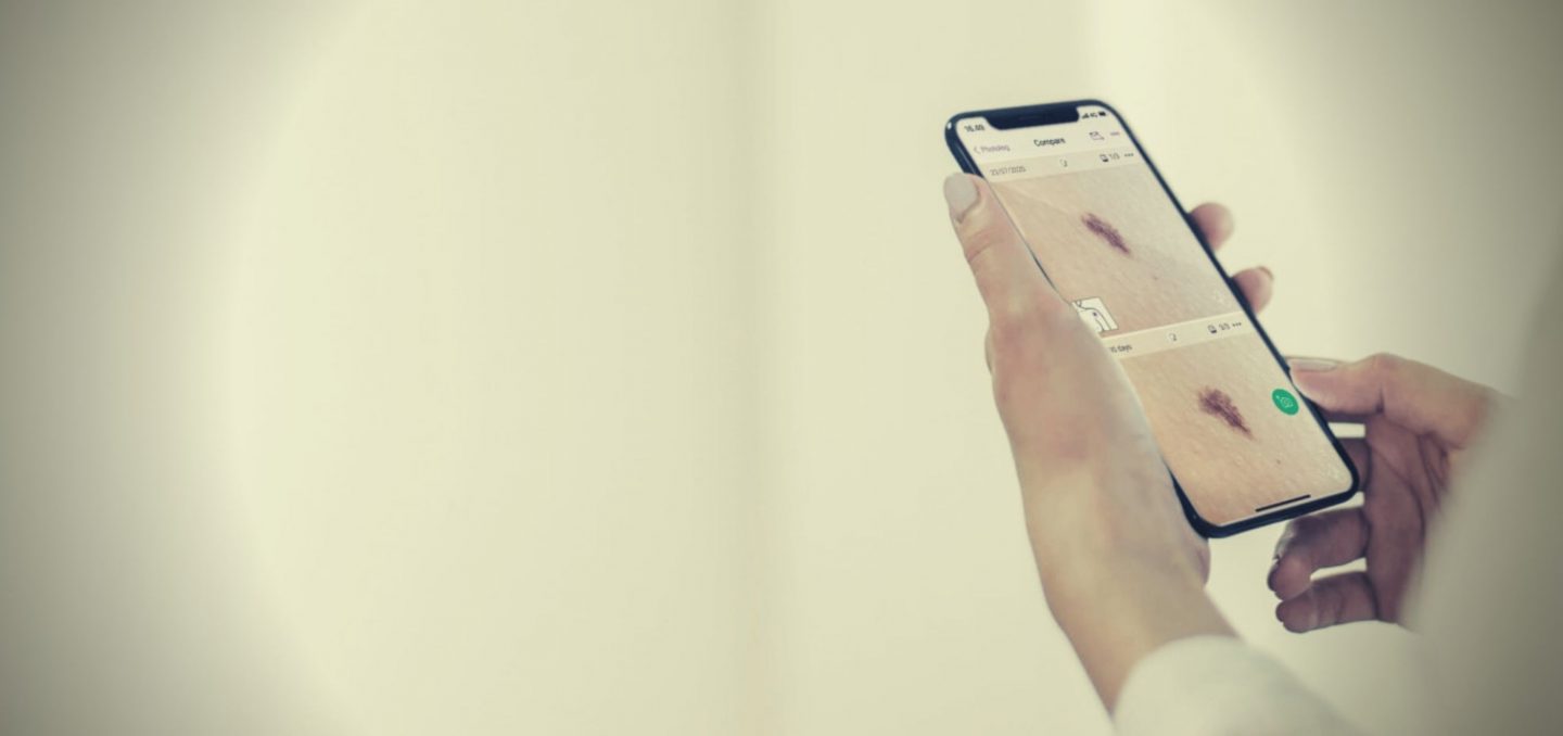 Miiskin: un approccio semplice per un problema complesso